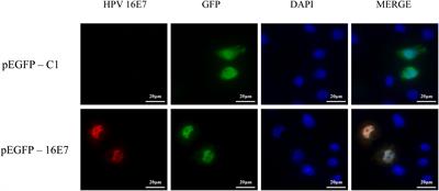 Digital RNA Sequencing of Human Epidermal Keratinocytes Carrying Human Papillomavirus Type 16 E7